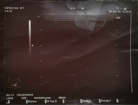 Linear Ultrasound Transducer — Hitachi EUP-L54MA thumbnail 2