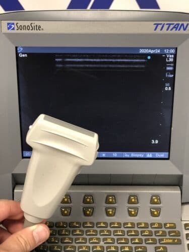 SonoSite TITAN Portable Ultrasound System with L38 Linear Array Probe thumbnail 5