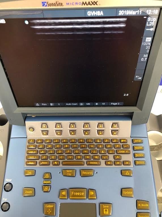 Sonosite L25e Linear Ultrasound Transducer Probe thumbnail 4