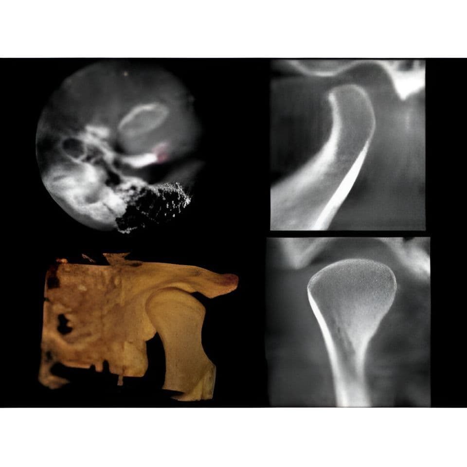 Carestream CS9000 Pan/CBCT 3D Dental X-Ray System thumbnail 5