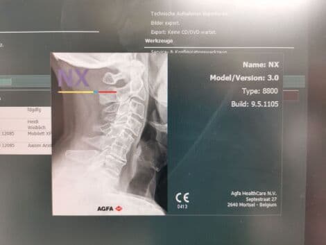 AGFA DX-M Computed Radiography System thumbnail 2