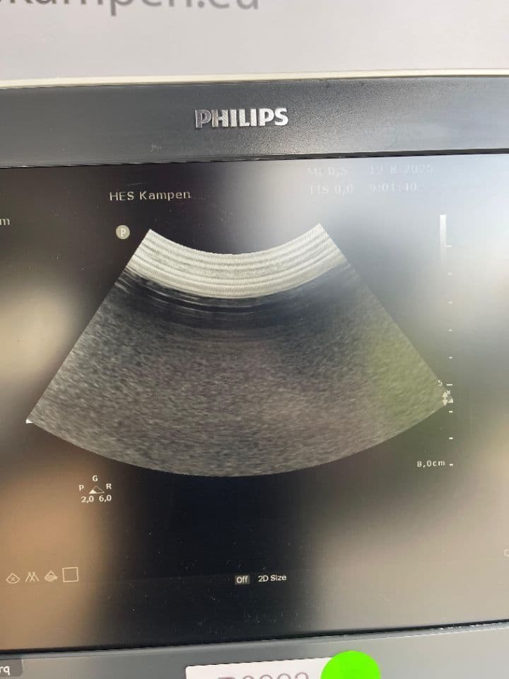 Philips Sparq Ultrasound System thumbnail 5