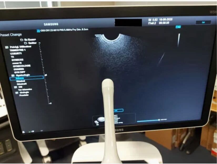 Samsung Medison V5-9 3D/4D Volume Convex Ultrasound Transducer thumbnail 3