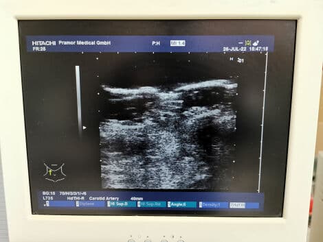 Hitachi EUP-L73S Linear Array Ultrasound Transducer thumbnail 8