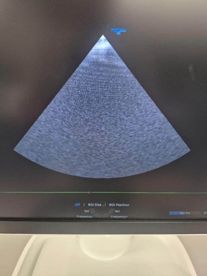 Samsung PA1-5A Phased Array Ultrasound Transducer thumbnail 5