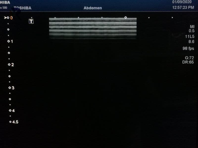 Toshiba PLT-704AT Linear Array Ultrasound Transducer thumbnail 3