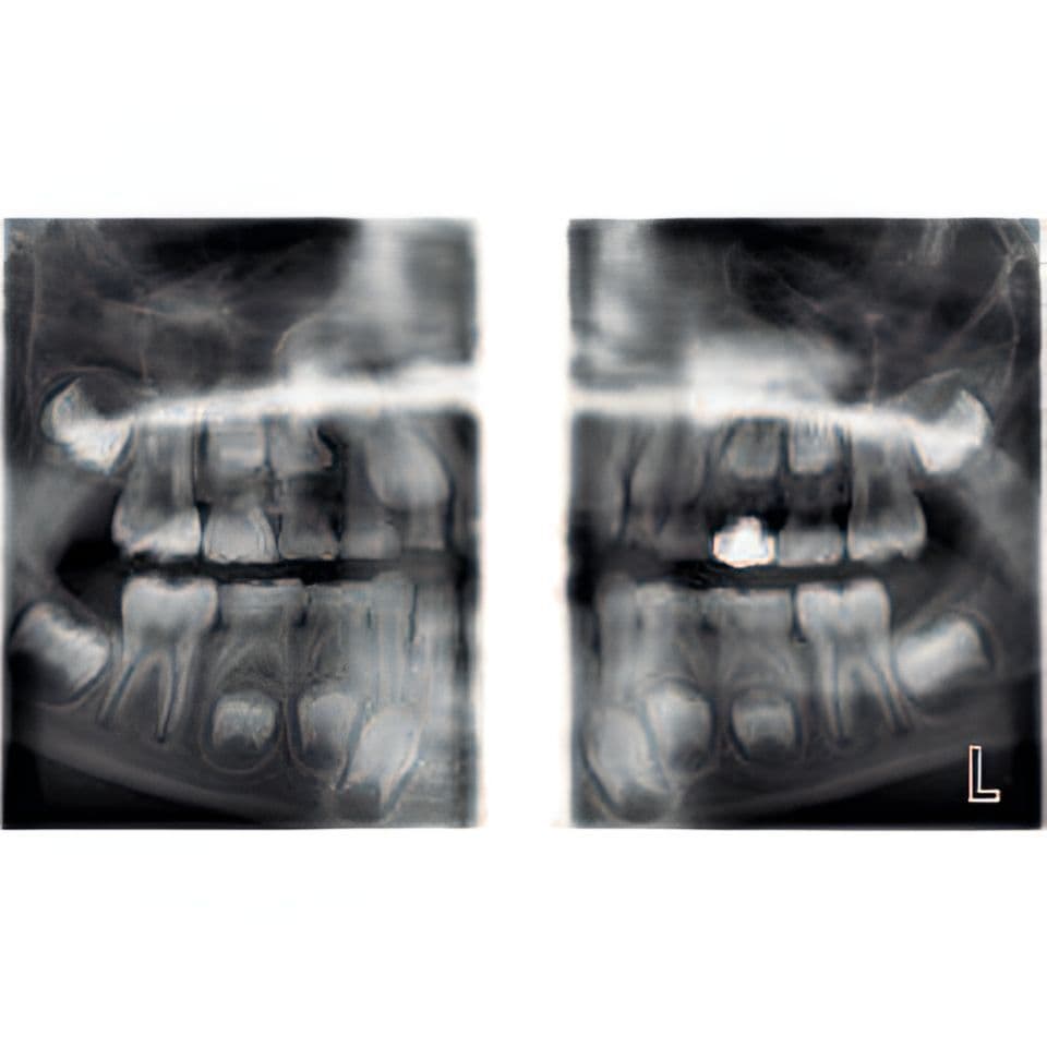 Planmeca ProMax Pan Dental X-Ray System thumbnail 6