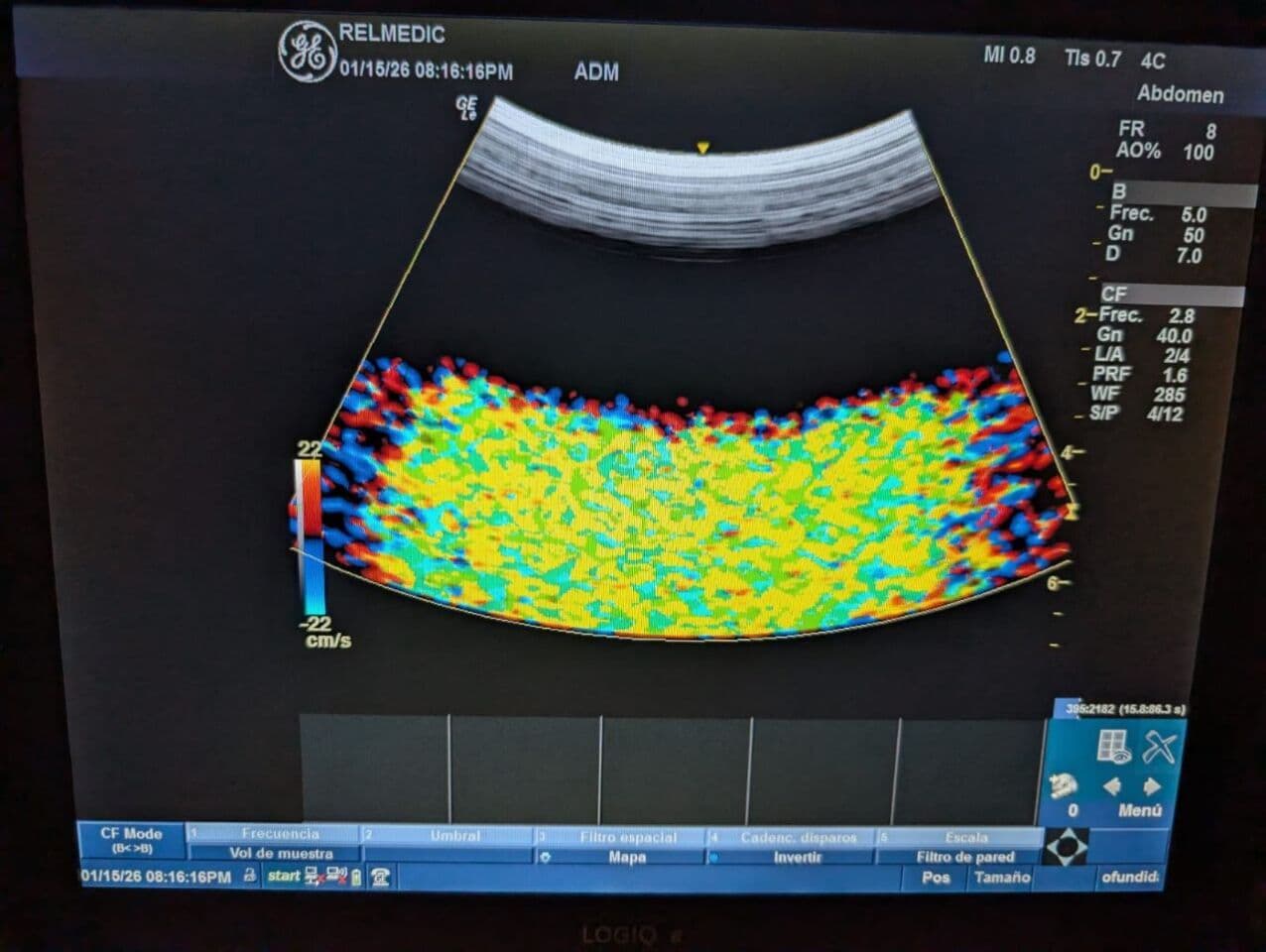 GE 4C-RS Convex Ultrasound Transducer thumbnail 7