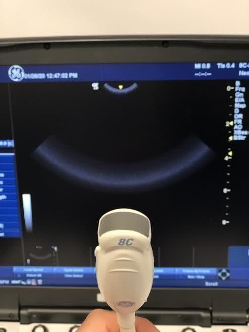 GE 8C-RS Micro Convex Ultrasound Transducer thumbnail 3