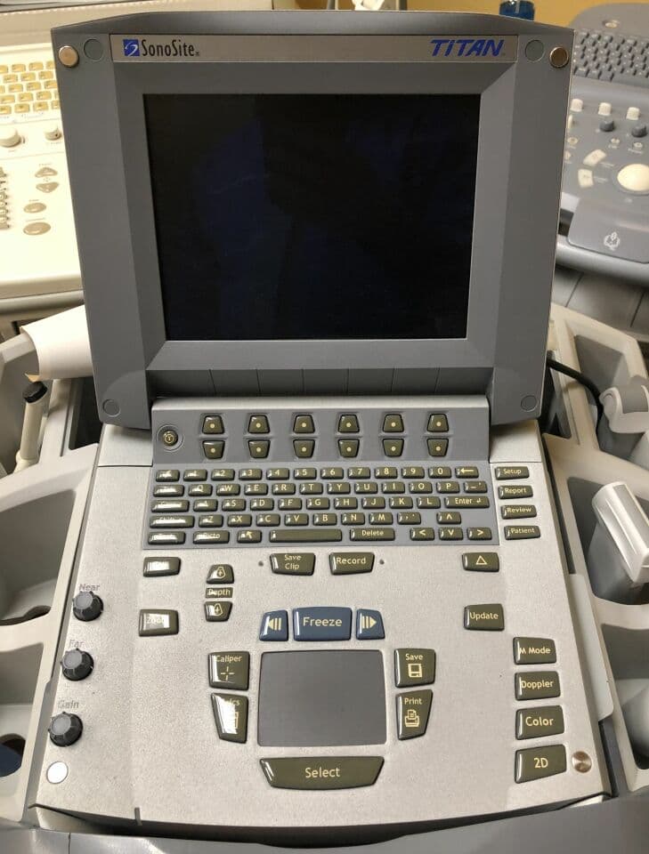 SonoSite Titan Ultrasound System with 3 Transducer Probes thumbnail 3