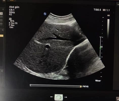 Philips C5-1 Convex Array Ultrasound Transducer thumbnail 3