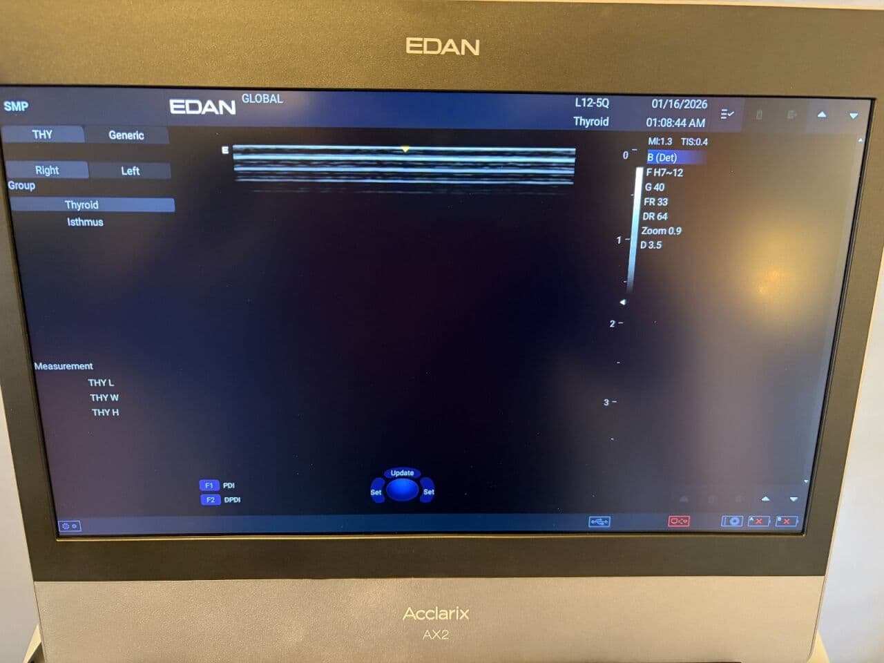 Edan Acclarix AX2 Portable Diagnostic Ultrasound System thumbnail 11