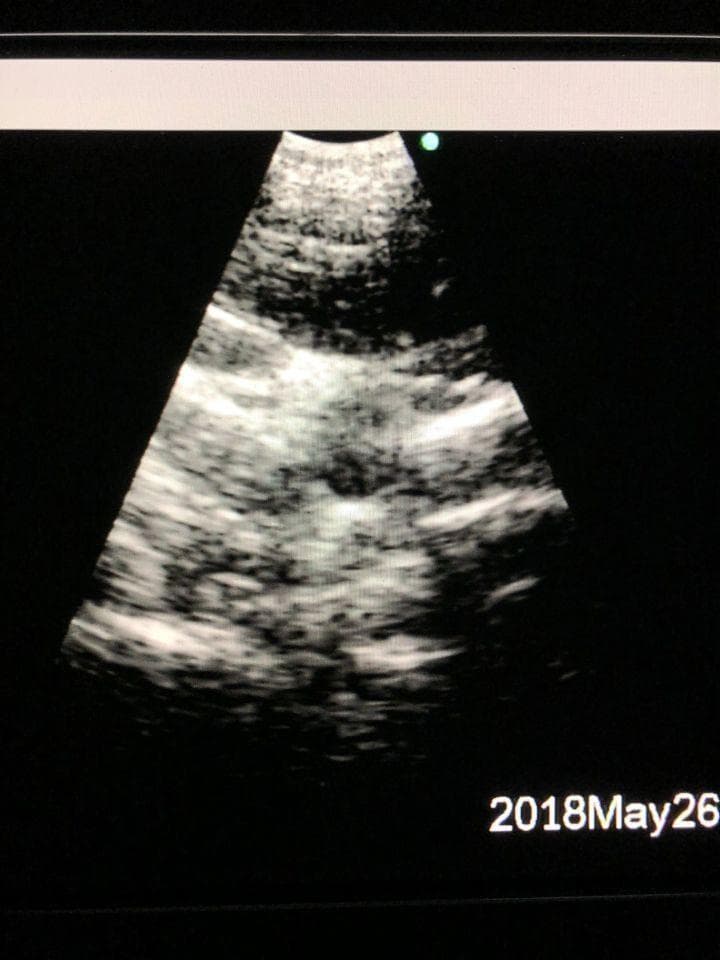 Olympus EU-C60 Endoscopic Ultrasound Processor for EBUS Procedures thumbnail 3