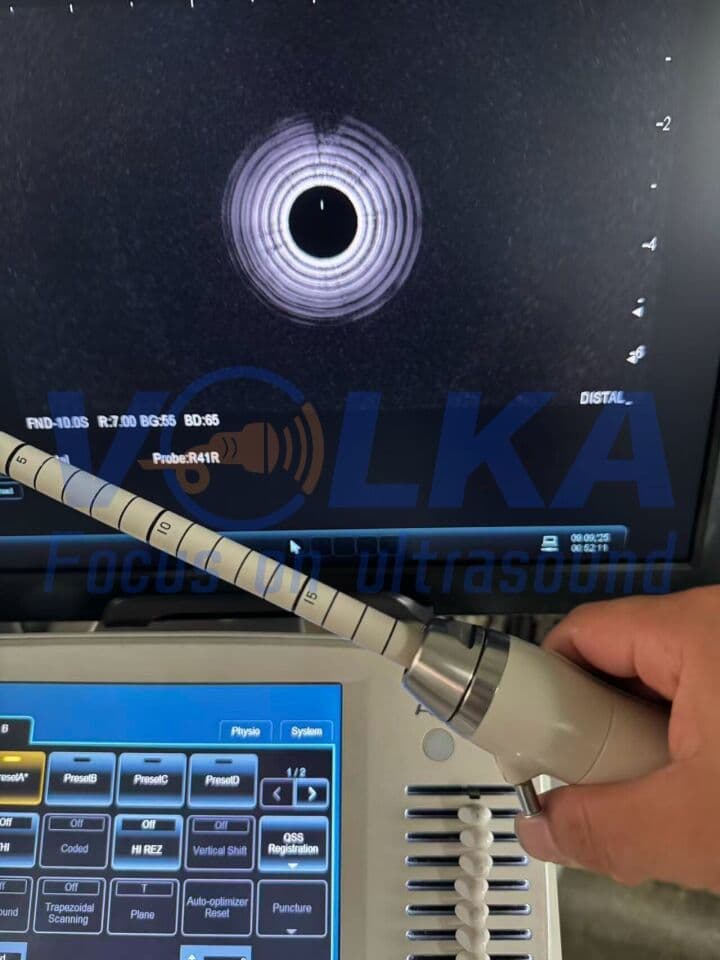 Hitachi EUP-R54AW-19 Endorectal Ultrasound Transducer image 1