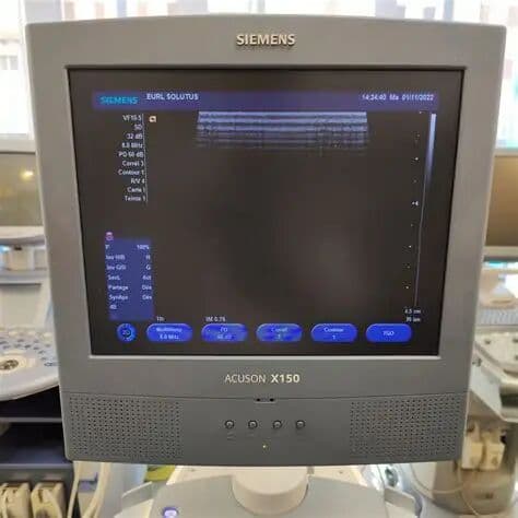 Siemens Acuson X150 Ultrasound System image 1