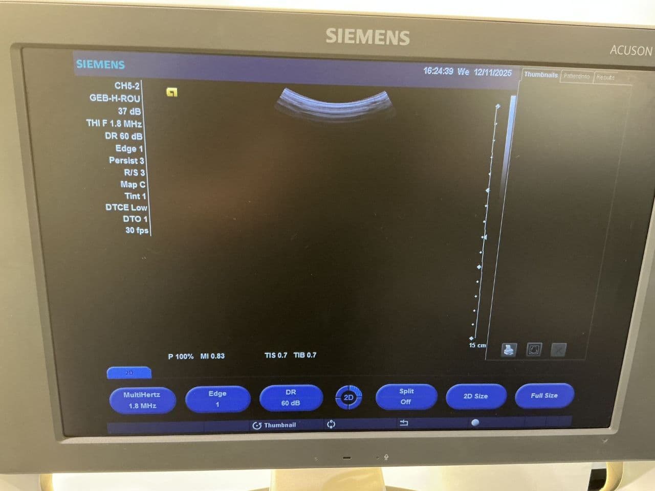 For Sale SIEMENS X300 OB / GYN Ultrasound thumbnail 3