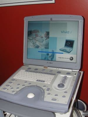 GE Vivid i Portable Shared Service Ultrasound System image 1
