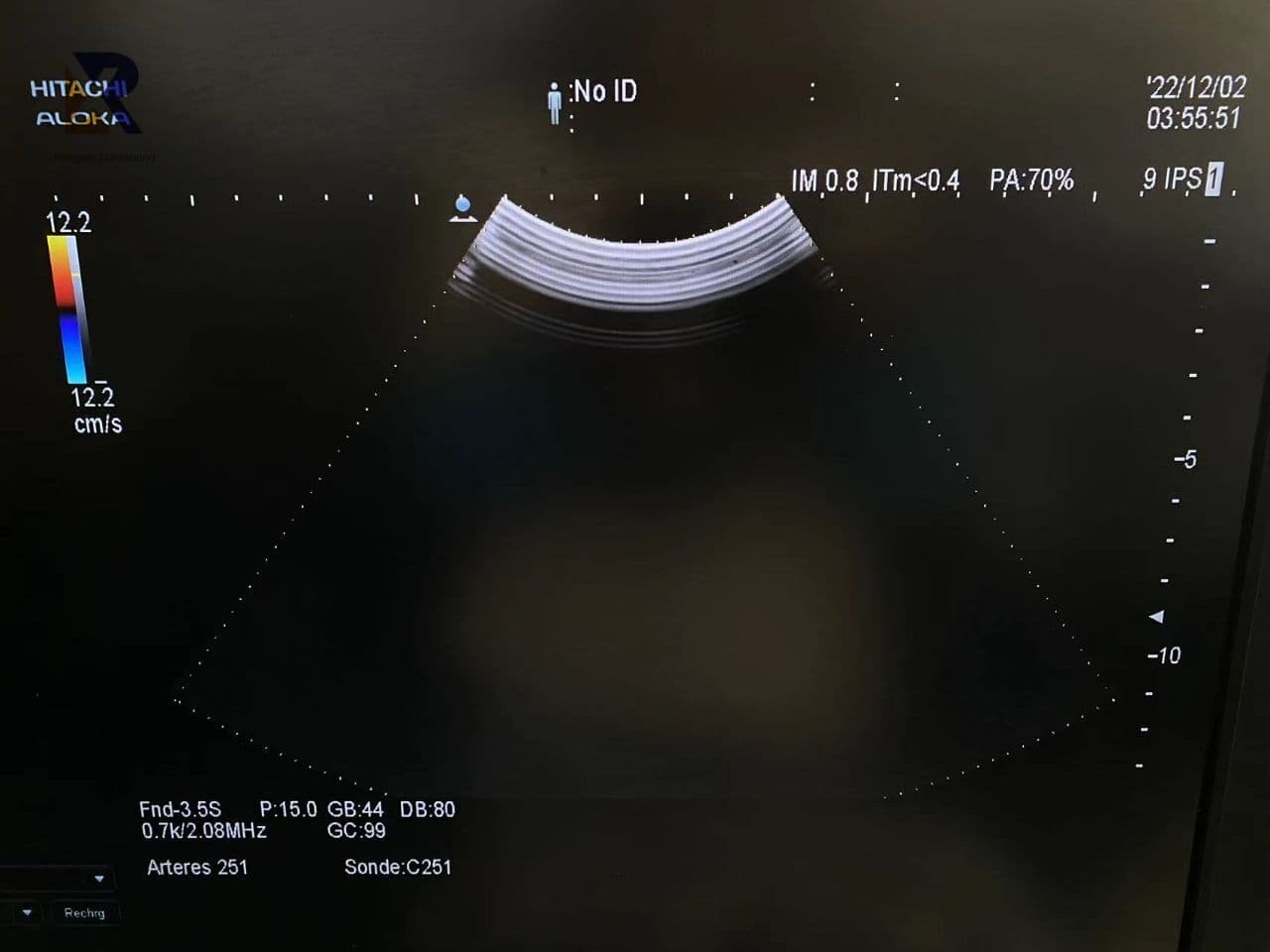 Hitachi C251 Convex Ultrasound Transducer thumbnail 4