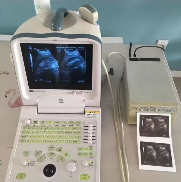 Mindray DP6600 Portable Ultrasound Scanner with Convex Probe image 1