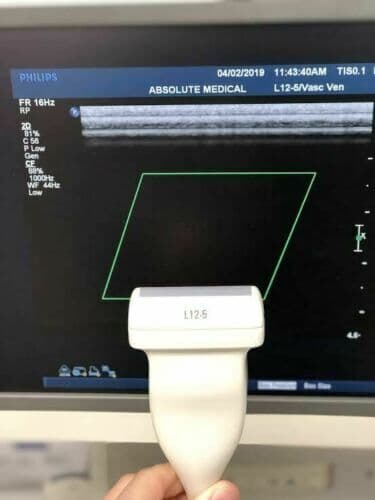 Philips L12-5 Linear Array Ultrasound Transducer Probe thumbnail 3