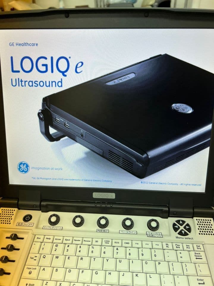 GE Logiq e Portable Shared Service Ultrasound System thumbnail 3