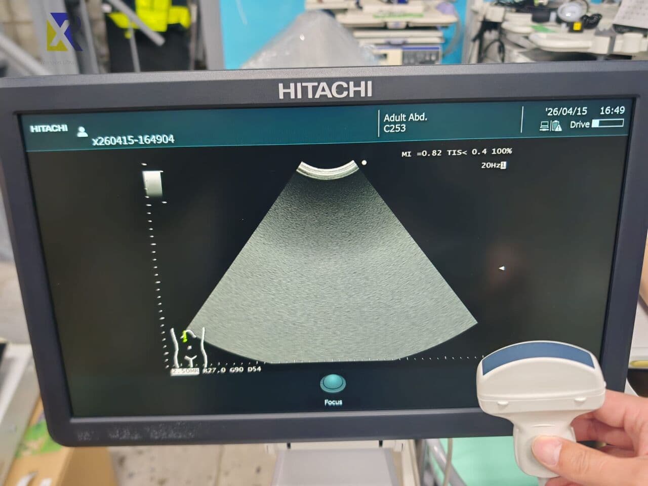 Hitachi Arietta 50 Ultrasound System thumbnail 2