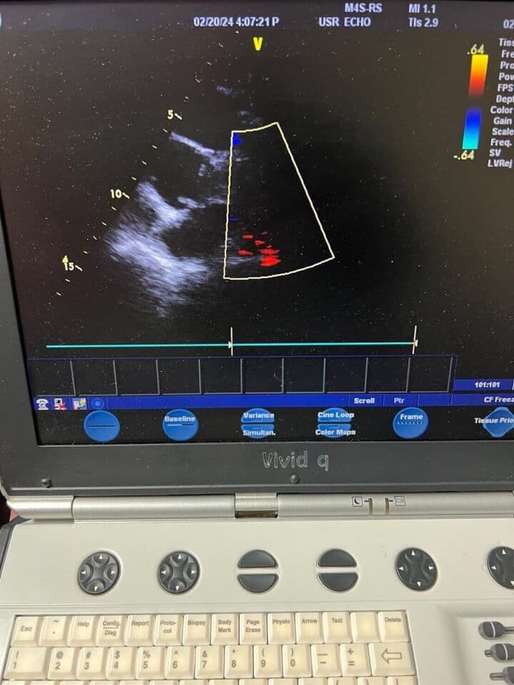 GE Vivid Q Portable Echocardiography Ultrasound System thumbnail 6