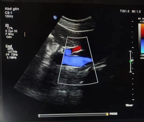 Philips C5-1 Convex Array Ultrasound Transducer thumbnail 2