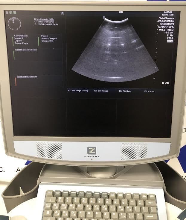 ZONARE C6-2 Convex Ultrasound Transducer Probe thumbnail 3