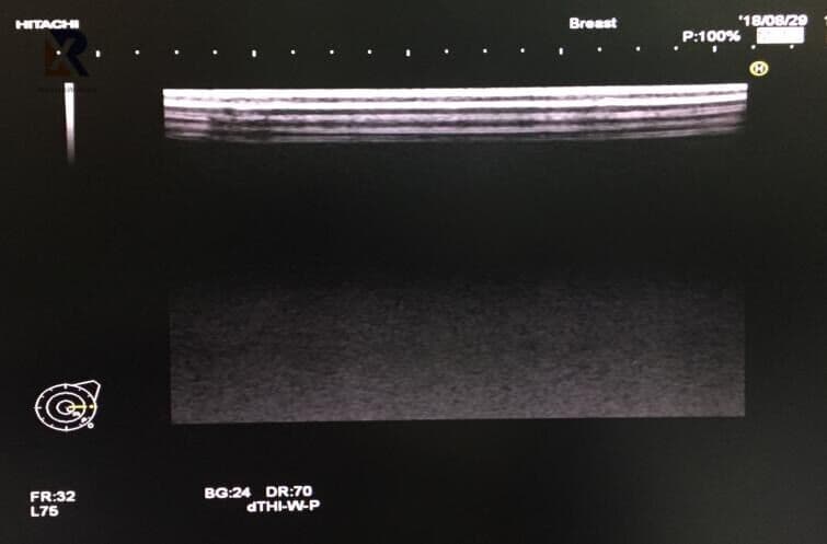 Hitachi EUP-L75 Linear Array Ultrasound Transducer thumbnail 4