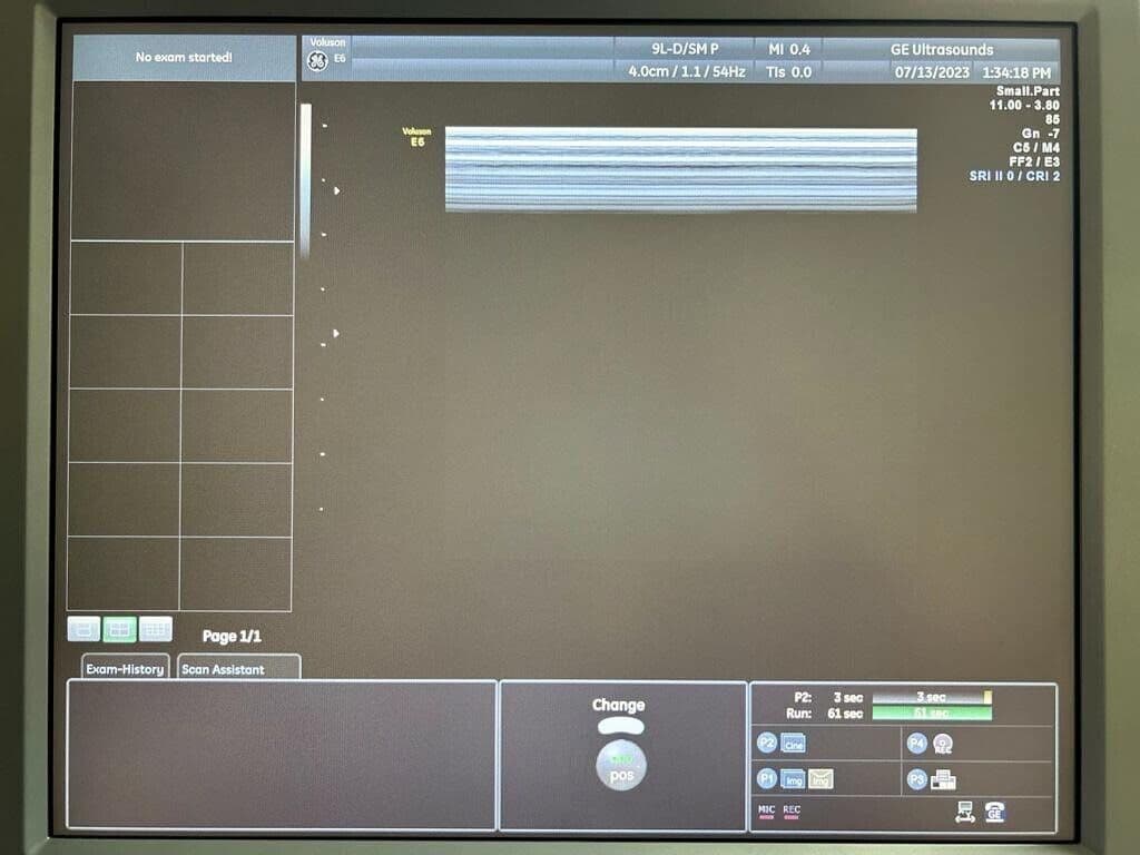 GE 9L-D Linear Array Ultrasound Transducer thumbnail 2