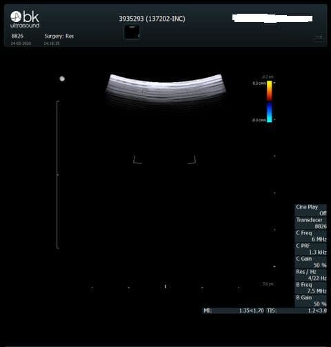Robotic Drop-In Ultrasound Transducer — BK Medical 8826 thumbnail 5