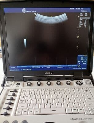 GE Logiq E Portable Ultrasound System thumbnail 6