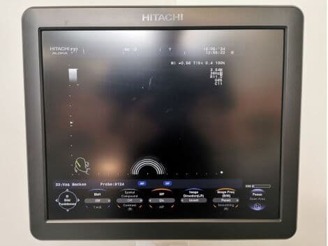Hitachi Aloka F-37 Ultrasound System with UST-9123, UST-568, and UST-9124 Probes thumbnail 9