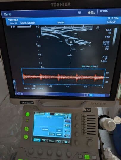 Toshiba PLU-1005BT Linear Ultrasound Transducer thumbnail 7