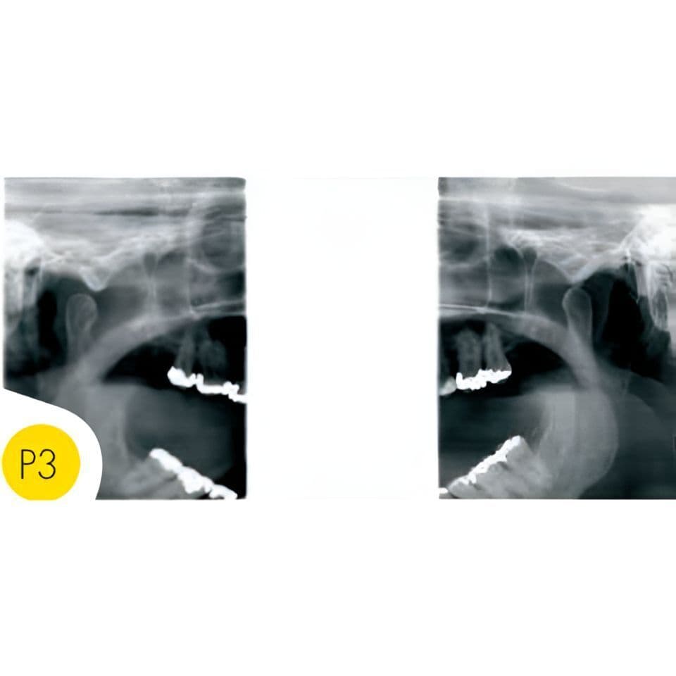 Instrumentarium OP30-2 Pan Digital Panoramic Dental X-Ray thumbnail 3