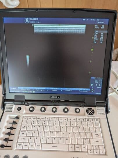 GE 9L-RS Linear Array Ultrasound Transducer thumbnail 9