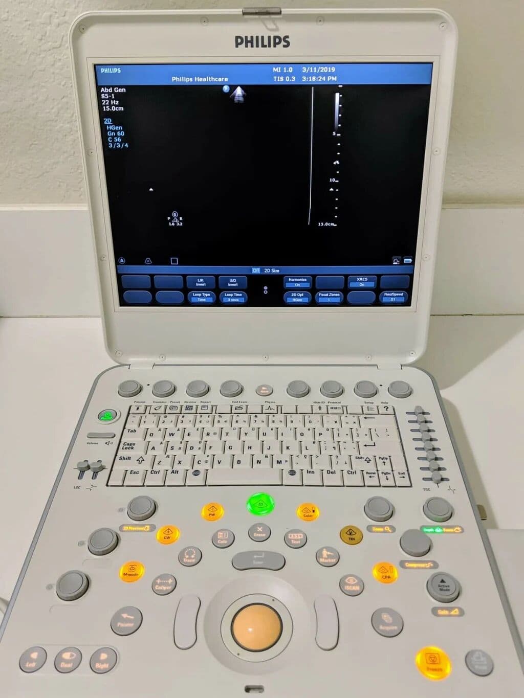 Philips CX50 Portable Ultrasound System image 1