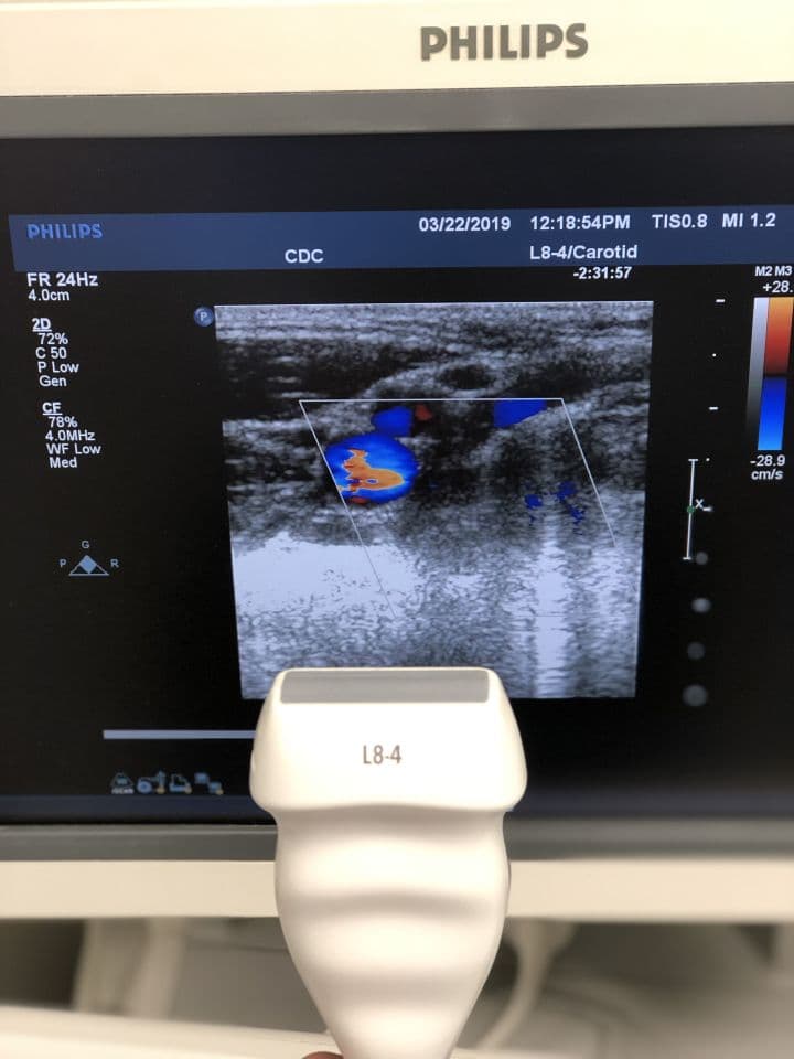 Philips L8-4 Linear Ultrasound Transducer Probe image 1