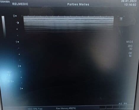 Toshiba PLT-1204BT Linear Ultrasound Transducer thumbnail 6
