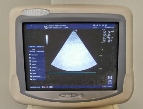 GE Logiq 7 Cardiac Ultrasound System thumbnail 10