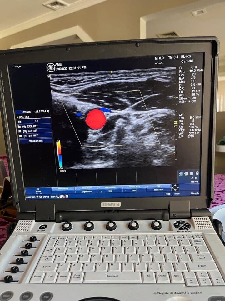 GE 9L-RS Linear Array Ultrasound Transducer for Vascular and Small Parts Imaging thumbnail 3