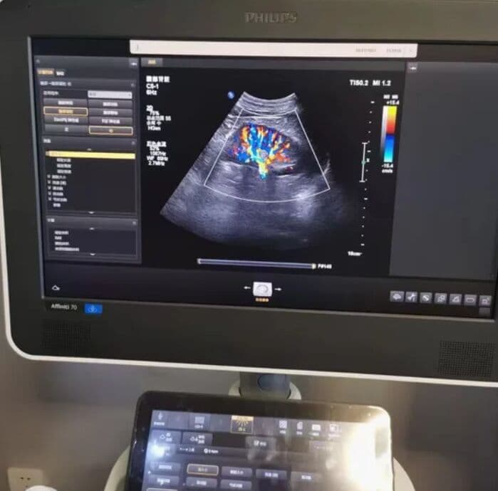 Philips Epiq 5 / Epiq 7 Ultrasound Machine LCD Monitor - 453561700442 image 1