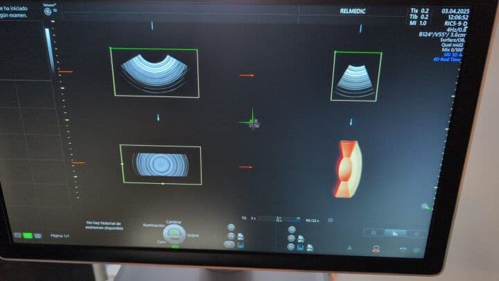 GE Voluson E8 OB/GYN Ultrasound System thumbnail 8