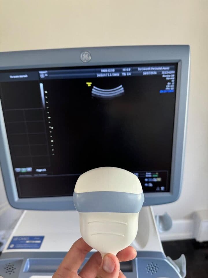 GE Voluson E6 3D/4D Ultrasound System thumbnail 2