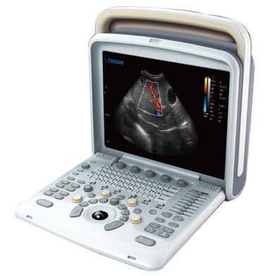 General Ultrasound Unit by Chison — Model Q9 thumbnail 3