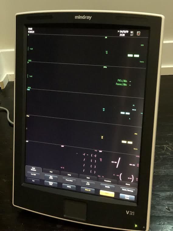Mindray V21 Patient Monitor thumbnail 2