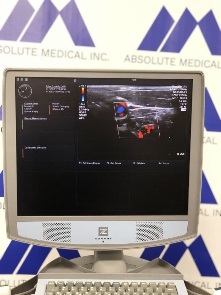 ZONARE L14-5W Linear Ultrasound Transducer thumbnail 2