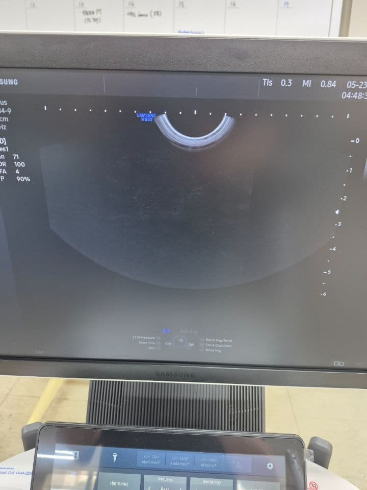Samsung EVN4-9 Transvaginal Ultrasound Transducer thumbnail 5