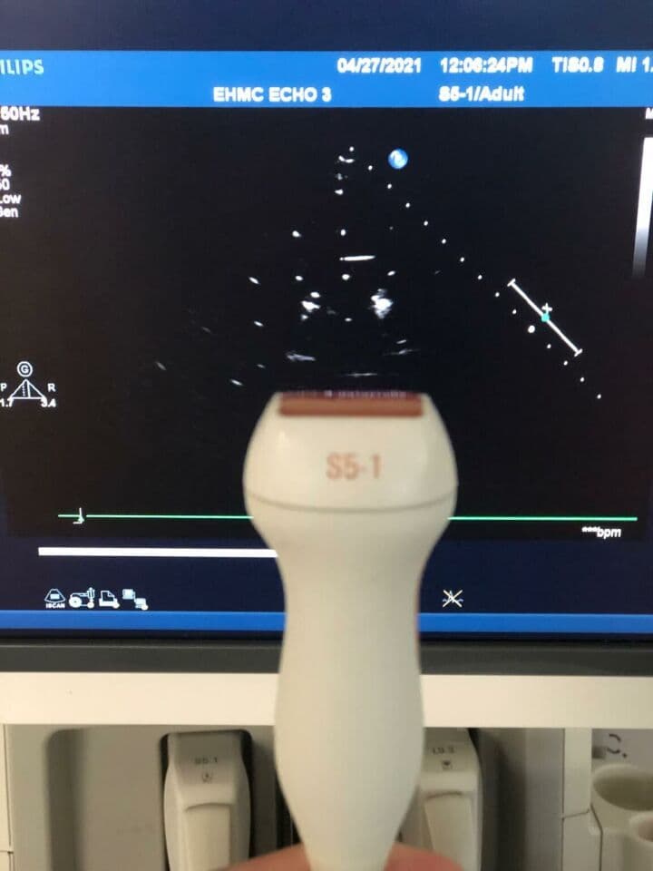 Philips iE33 Diagnostic Ultrasound System thumbnail 5